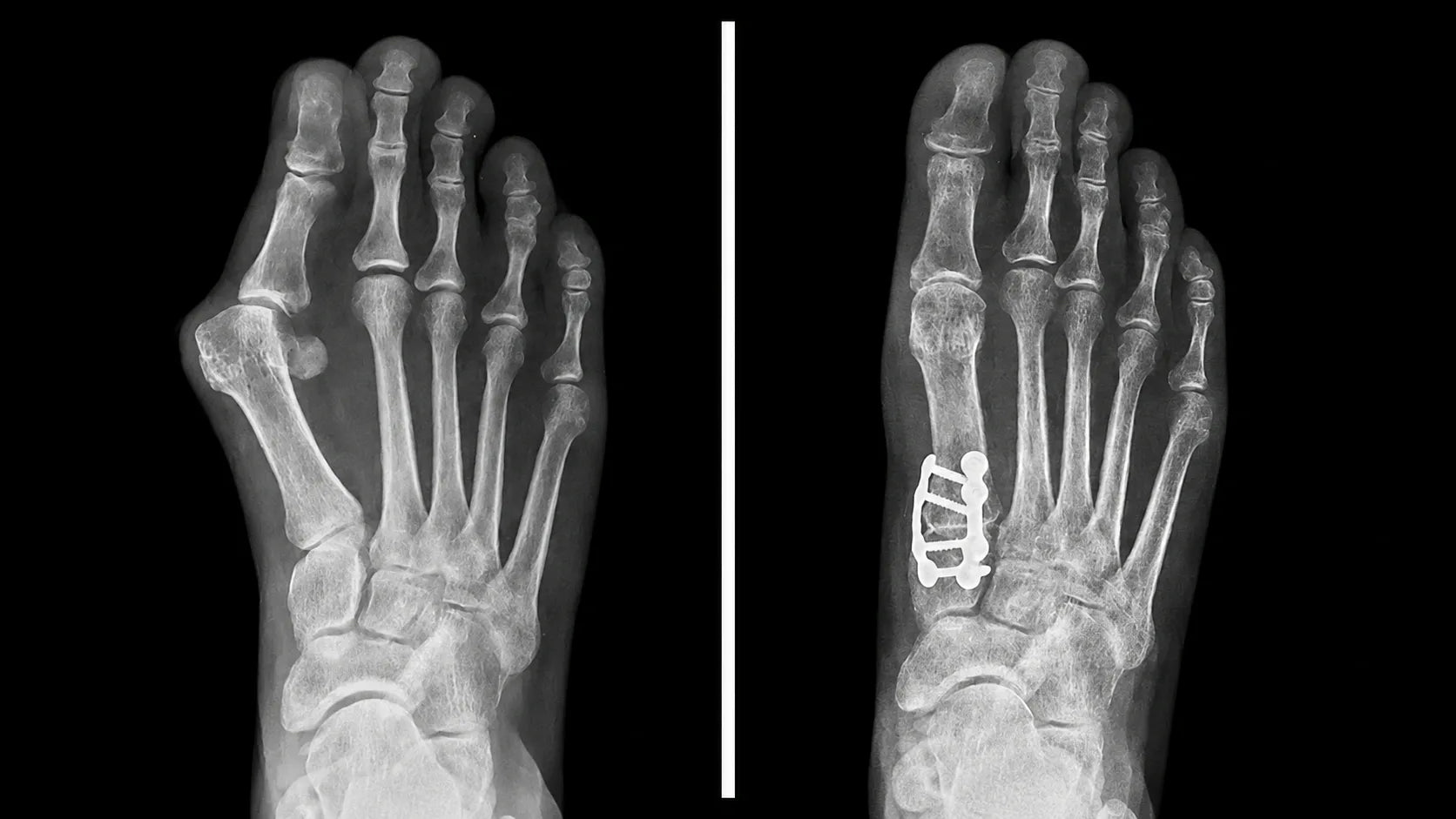 Radiografias