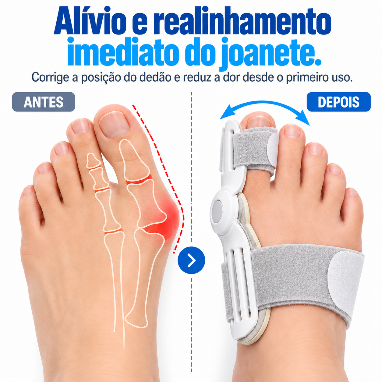 Par de Corretor OrtoZex™ Comfort Pro — ajuste de velcro em 5 níveis