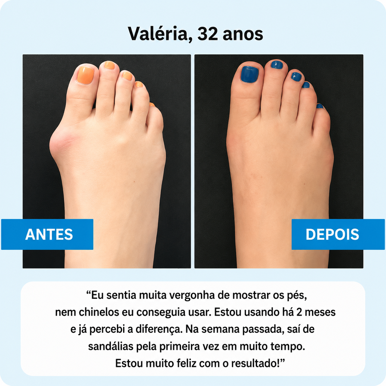Par de Corretor OrtoZex™ Comfort Pro — ajuste em 5 níveis