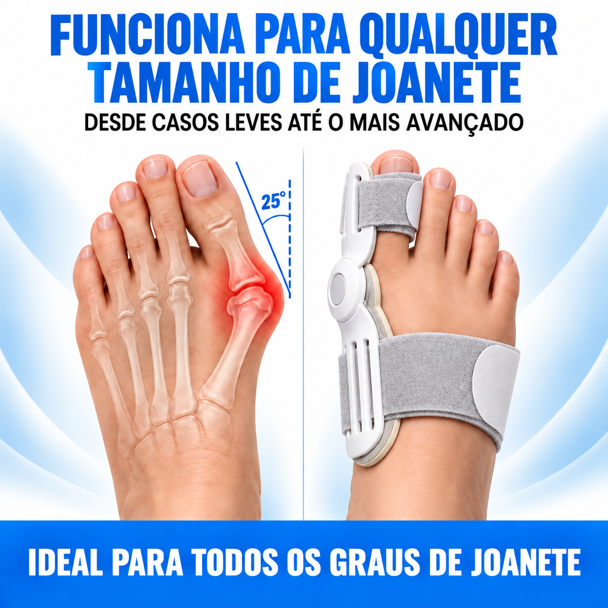 Par de Corretor OrtoZex™ Comfort Pro